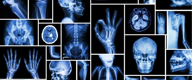 tbl articles article 18461 2440322db6d ad51 489b adaa 4f463a7dfbb8