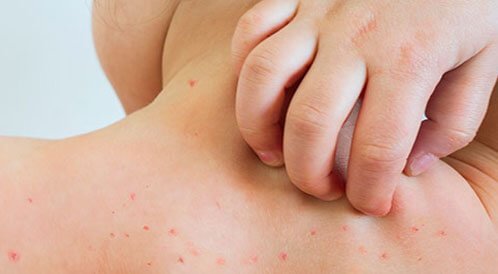 tbl articles article 21413 60807f0e094 a5c4 4545 ae20 5f7c5de7647b