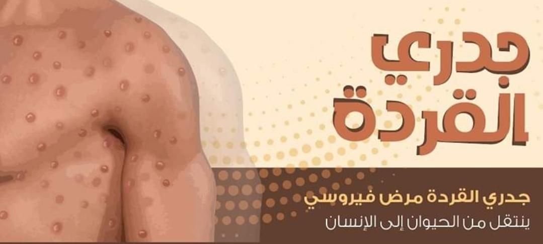 وزارة الصحة.. كيف تحمي نفسك من جدري القرود 16 IMG 20220922 133033 327