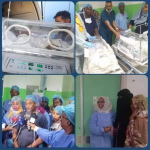 فصل توأم سيامي بالخرطوم 12 FB IMG 1669405119837