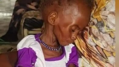 اطباء السودان:تجاهل ازمة اطفال دارفور وصمة عار على المجتمع الدولي 14 17264304091162