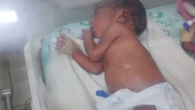 سيدة تنجب خمسة توأم 17 e7c4d830 eec2 4b03 9d25 62d697295f72