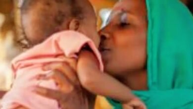 الأغذية العالمي ينشر أحصائية عن سوء التغذية بين الاطفال 18 17373038343452