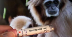 جوبا تعلن عن تفشي جدري القرود