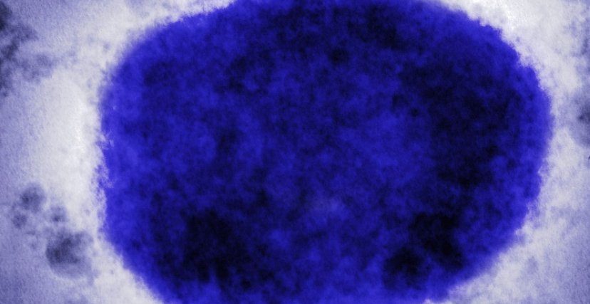 ٢١ ٠٦ ٢٨ monkeypox virus GettyImages 758292709 a59c85adaca04a6c9d84b792274d12e8