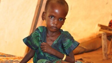 A malnourished child in an MSF treatment tent in Dolo Ado