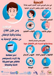 مرض الحصبة ينتشر بولاية الجزيرة 13 مرض الحصبة ينتشر بولاية الجزيرة