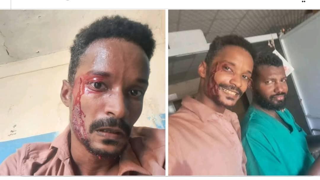 يا خبر.. أطباء يتعرضون للضرب من مسلحين بمستشفى.. تفاصيل مذهلة 11 IMG 20250607 WA0013