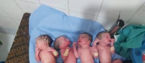 حدث نادر بمستشفى النساء والتوليد بمدني