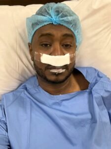 عملية ناجحة لفنان شهير 12 عملية ناجحة لفنان شهير