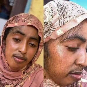 مأساة شابة .. تواجه ظاهرة غريبة وتطلق نداءً عاجلاً!!