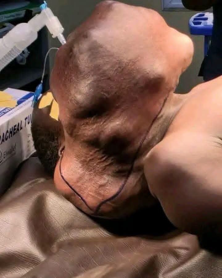 تفاصيل عملية جراحية معقدة في ولاية الجزيرة 11 IMG 20260714 WA0008