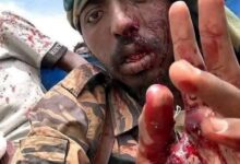 إصابة قائد ميداني مؤثر بالنيل الأزرق!! 5 IMG 20260905 WA0016