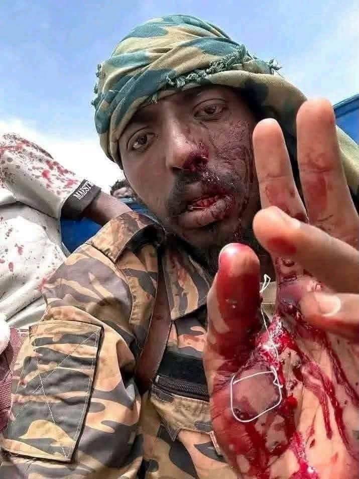 إصابة قائد ميداني مؤثر بالنيل الأزرق!! 2 IMG 20260905 WA0016